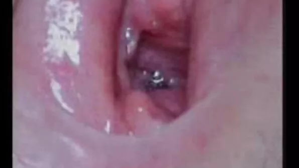 Armas tibu imes paksu riista.